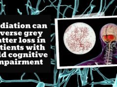Grey matter loss can be reversed by meditation in patients with mild cognitive impairment